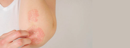 How inflammation affects your skin, gut, and joints